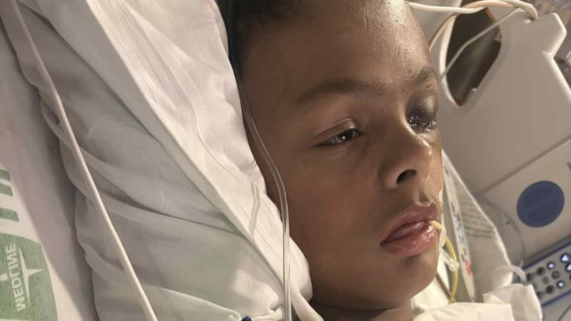 Ryen Harris-Contreras, 14, of Groesbeck, Texas, underwent surgery after he was shot and a...