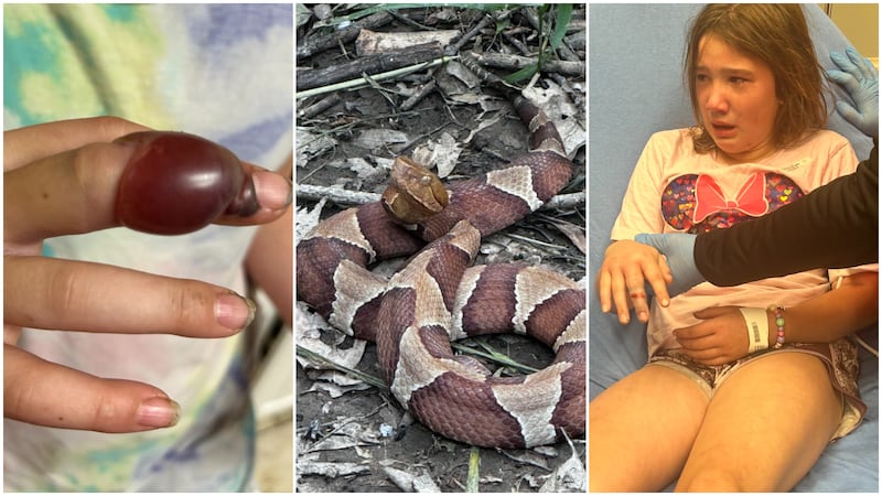 Eden Sibley pasó tres días en el hospital y recibió cuatro tratamientos antiveneno después de...