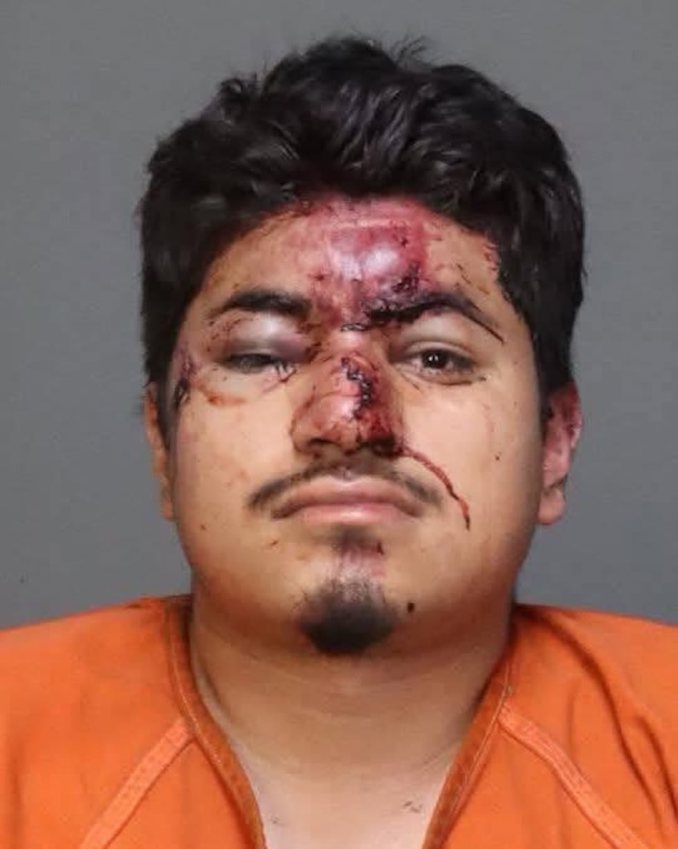 Matthew D. Cruz de 36 años, fue detenido por el Departamento de Policía de Beverly Hills y es...