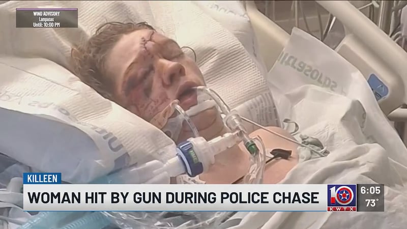 Killeen woman seeks justice after being severely injured by gun thrown from vehicle during...
