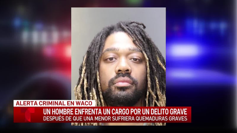 Un hombre es acusado después de que un niño pequeño de Waco sufriera graves quemaduras
