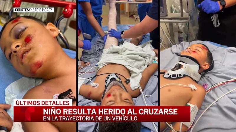 Menor de Temple resulta herido tras cruzarse en la trayectoria de un vehículo; crean una...